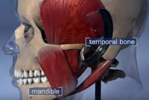 TMJ Treatment Dentist in Toronto