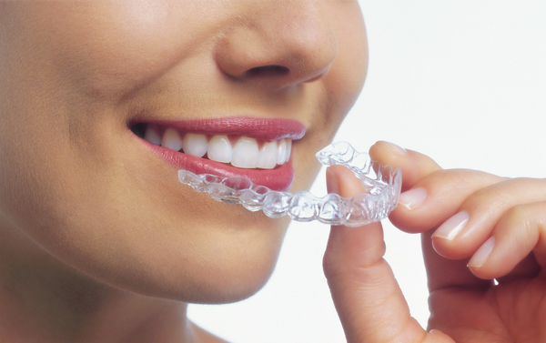 Invisalign clear aligners created from iTero Scanner impressions