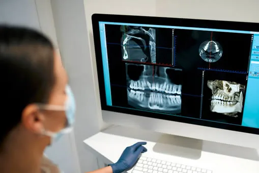 digital dental xray