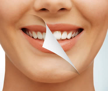 Regaining Your Confidence through Teeth Whitening